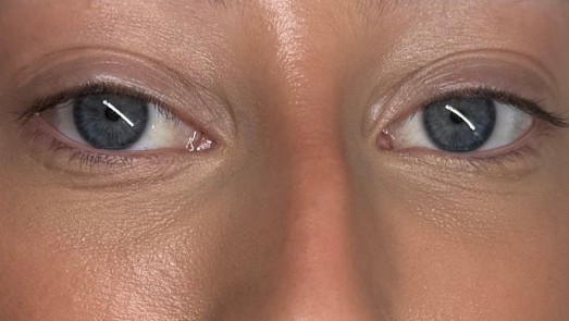 Wimpers voor de lashlift